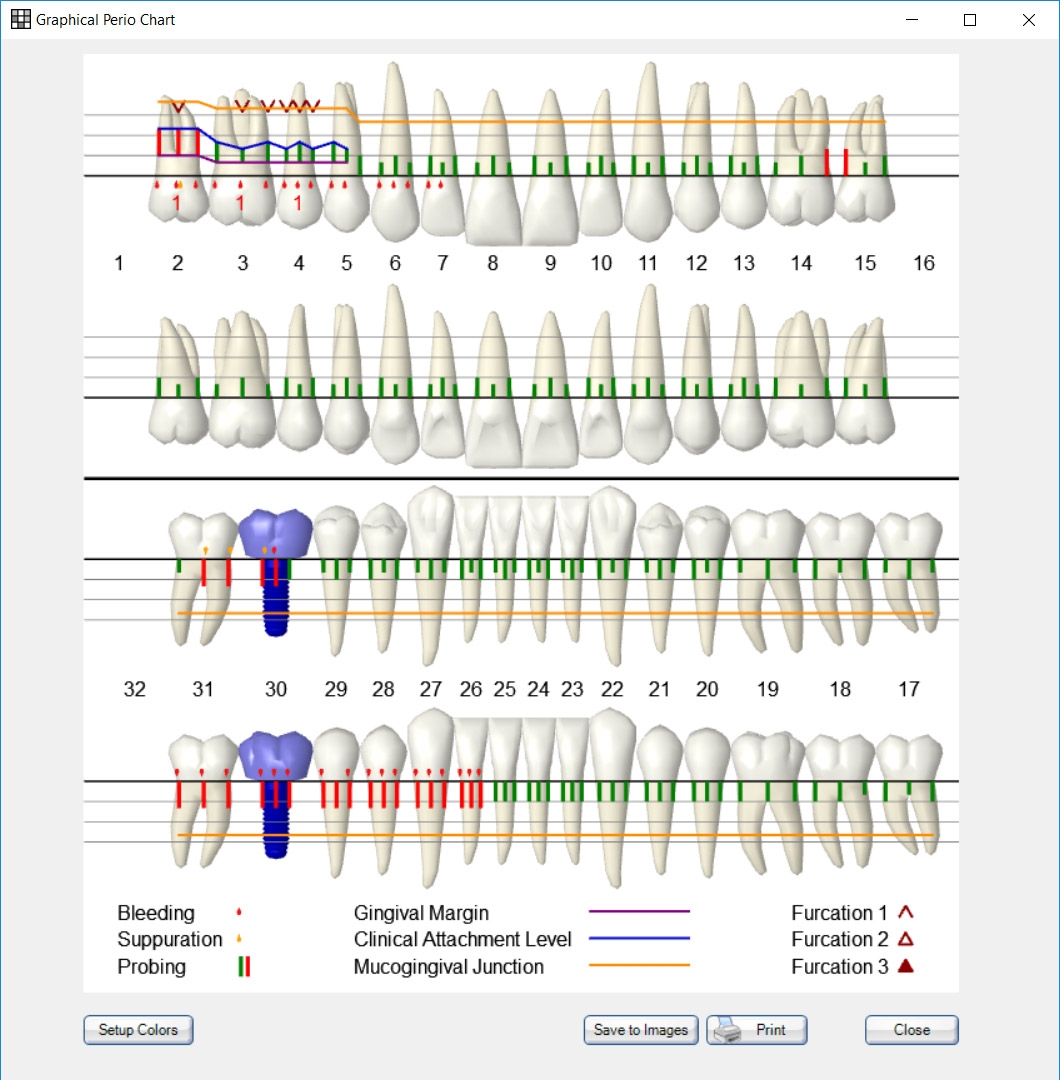 Free Printable Blank Periodontal Chart