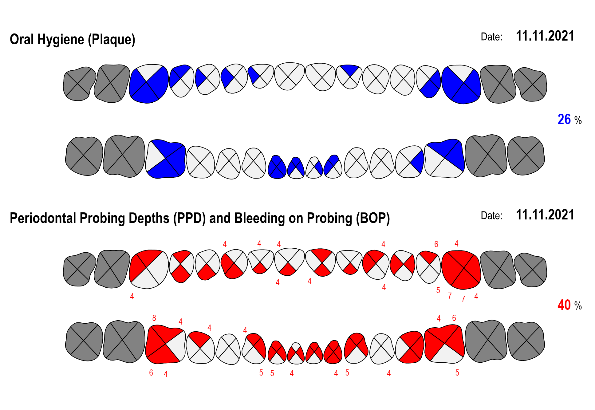 Periodontal Probing Chart Template
